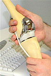 Kniegelenktotalendoprothese